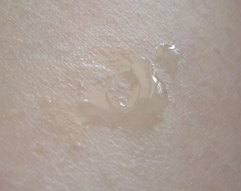 photo AcnesPointClear05.jpg
