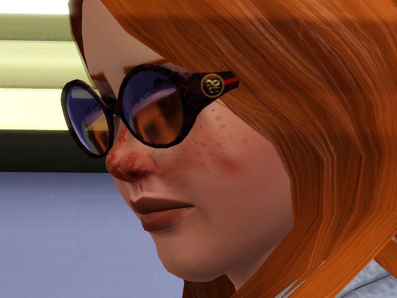 Fiona with wounds